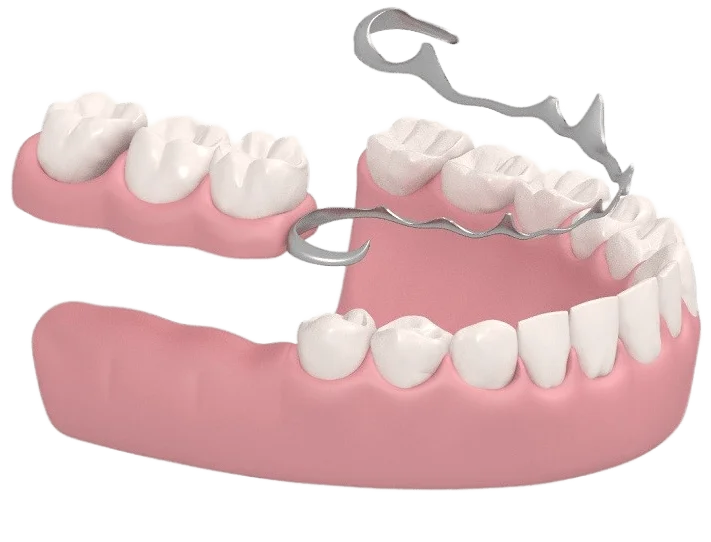 Баннер <span class="wow fadeTextBg animContrastTextBg">Бюгельные протезы для зубов в Уфе</span> на нижнюю и верхнюю челюсть