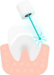 Баннер Диоксид циркониевые зубные коронки на зубы и импланты в Уфе