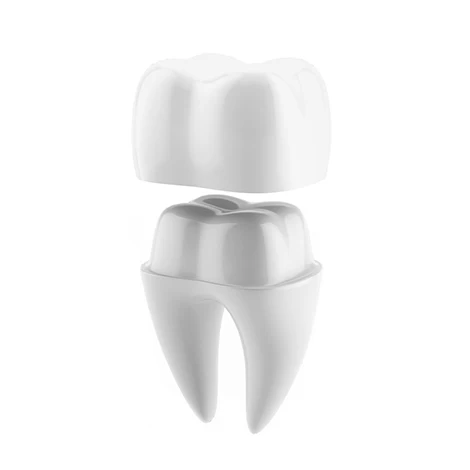 Баннер Коронка на зуб в Уфе под ключ – установка на передние и задние коренные зубы